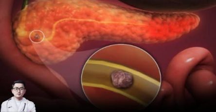 20 3 (1)